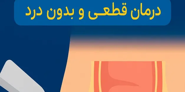 درمان هموروئید با لیزر