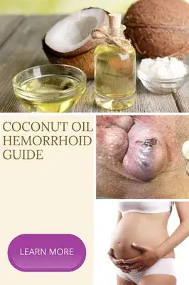 درمان سریع آبسه در باسن که باید بدانید!