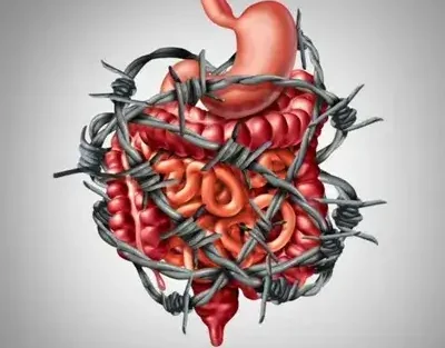 علت التهاب روده خطرناک است و چطور درمان می‌شود؟