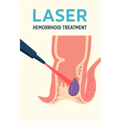 مراحل انجام لیزر سرپایی هموروئید توسط جراح متخصص