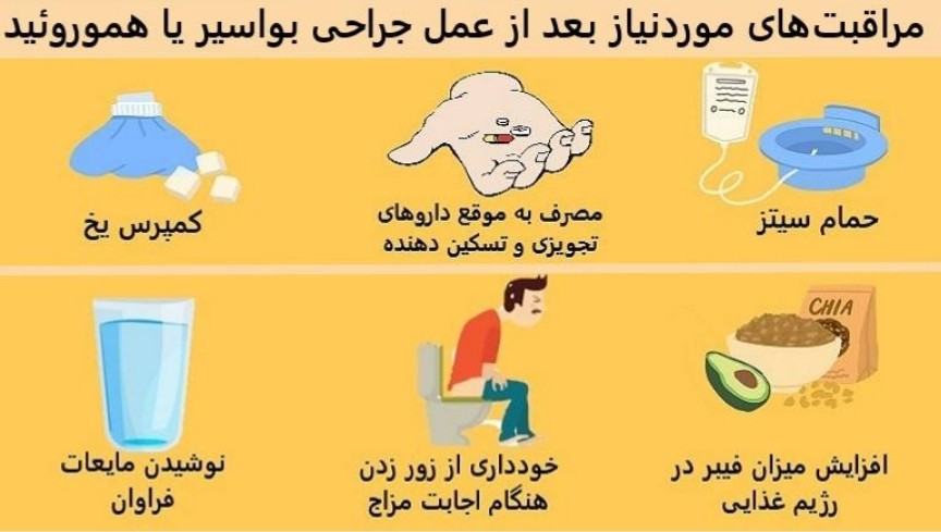 مراقبت های بعد از درمان بواسیر