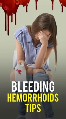 درمان خانگی بواسیر در زنان با روش‌های طبیعی