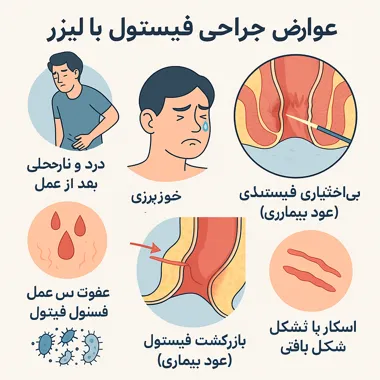 عوارض جراحی فیستول با لیزر
