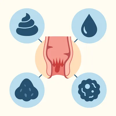 التهاب نشیمنگاه با خونریزی و عوامل مؤثر رکتوم