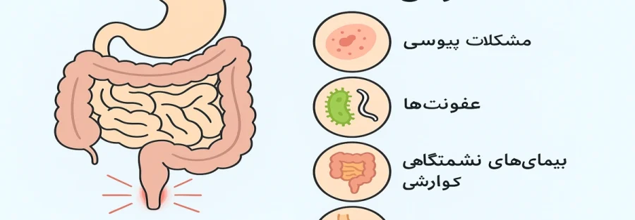 علت خارش مقعد و عوامل شایع به صورت شماتیک آموزشی