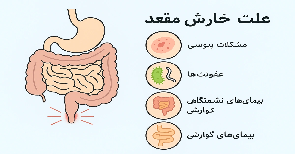 علت خارش مقعد و عوامل شایع به صورت شماتیک آموزشی