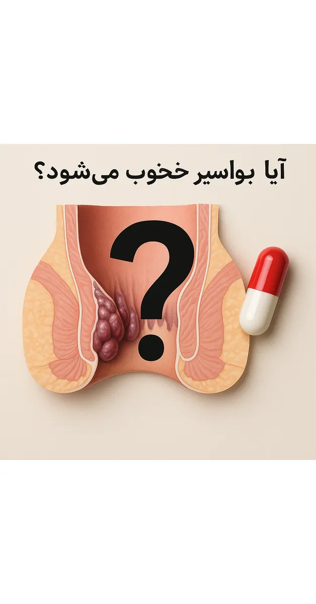 آیا بواسیر خودش خوب می‌شود؟