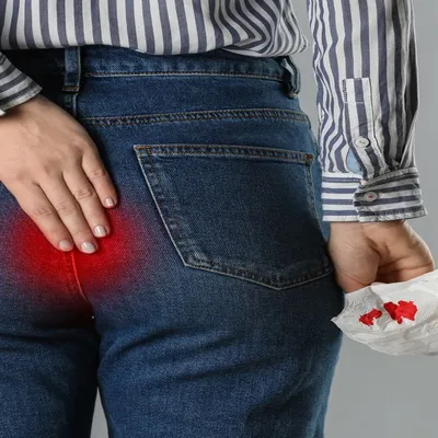 خونریزی مقعدی و عفونت نشیمنگاه