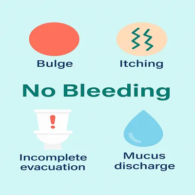 اینفوگرافیک علائم شایع بواسیر داخلی مثل برآمدگی، خارش و ترشح