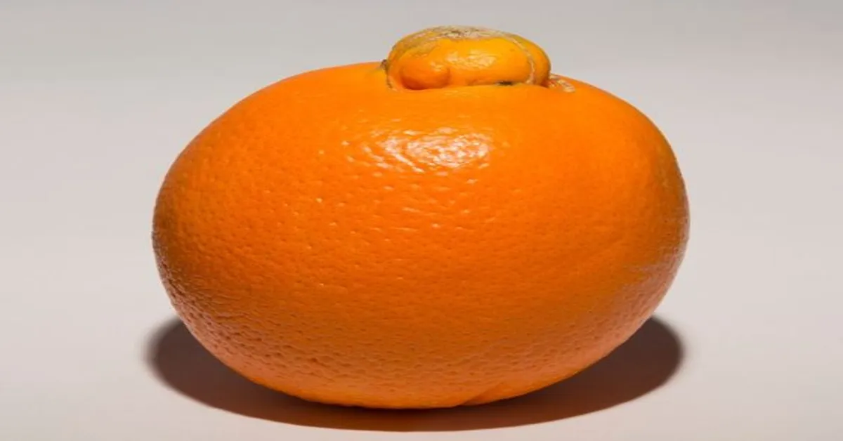 عمل زیبایی مقعد