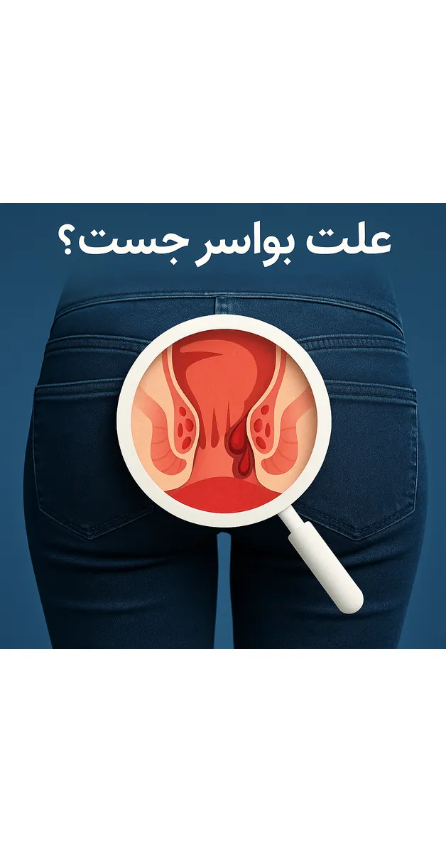علت بواسیر چیست؟