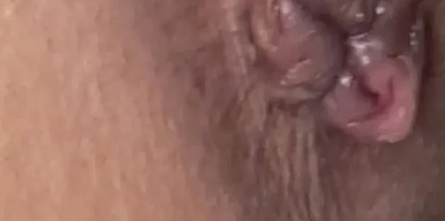 علائم بواسیر داخلی در مردان