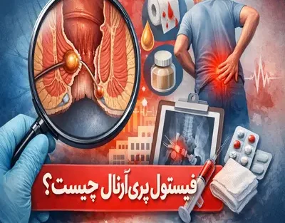 فیستول پری‌آنال چیست؟