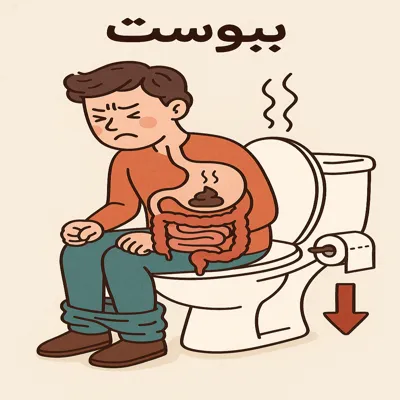 درمان خانگی زخم مقعدی