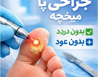 جراحی میخچه پا