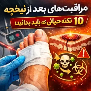 مراقبتهای بعد از لیزر میخچه