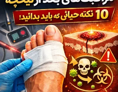 مراقبت‌های بعد از لیزر میخچه