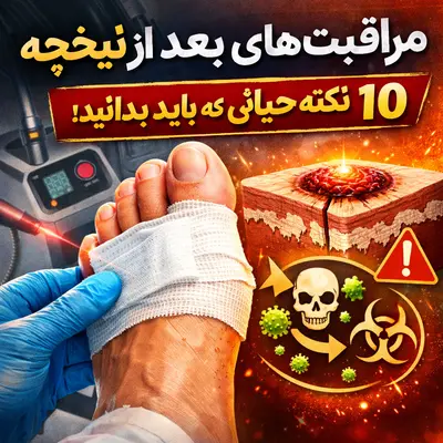 مراقبتهای بعد از لیزر میخچه