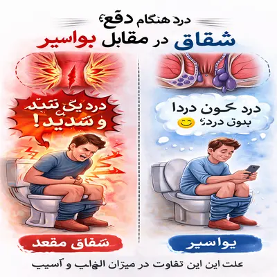 درد شدید شقاق در دفع، درد خفیف‌تر بواسیر