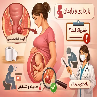 گوشت اضافه مقعدی در زنان
