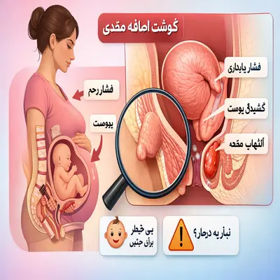 علت گوشت اضافه مقعدی در زنان